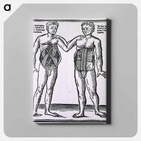 アートパネル-Abdominal Muscles
 - 国立医学図書館 Canvas.