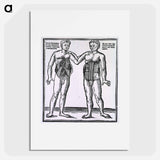 アートポスター-Abdominal Muscles
 - 国立医学図書館 Poster.