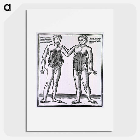 アートポスター-Abdominal Muscles
 - 国立医学図書館 Poster.
