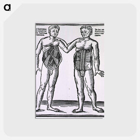 アートポストカード-Abdominal Muscles
 - 国立医学図書館 Postcard.