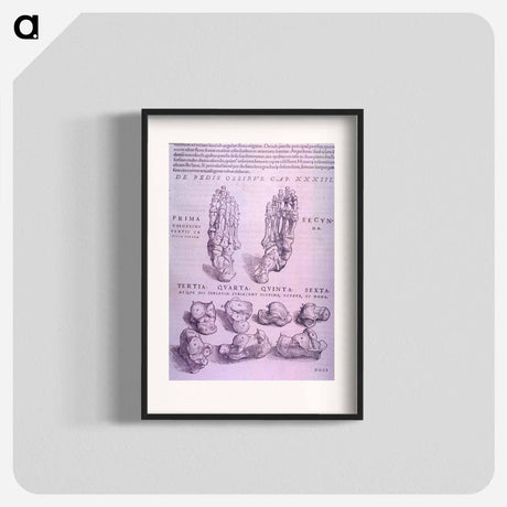 アートポスター-Superior and Inferior Views of a Bone Plate
 - 国立医学図書館 Poster.