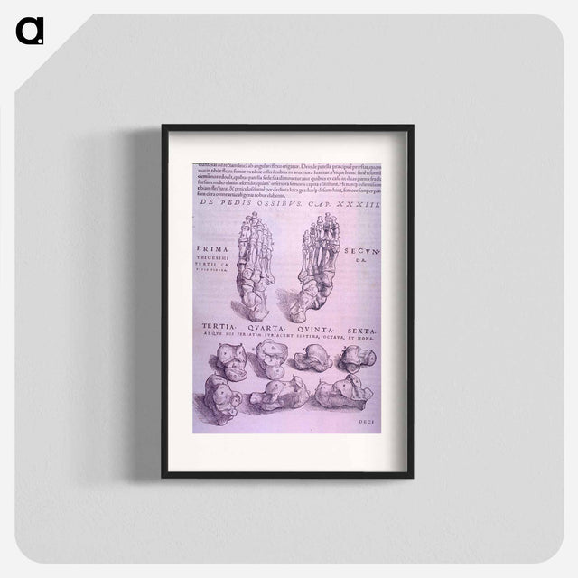 アートポスター-Superior and Inferior Views of a Bone Plate
 - 国立医学図書館 Poster.