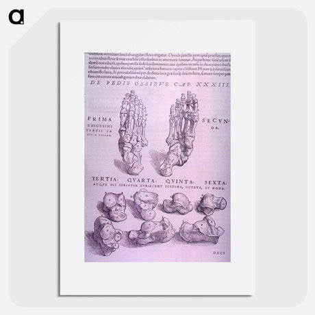 アートポスター-Superior and Inferior Views of a Bone Plate
 - 国立医学図書館 Poster.