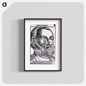 アートポスター-Treatment of Cyst
 - 国立医学図書館 Poster.