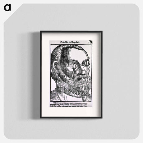 アートポスター-Treatment of Cyst
 - 国立医学図書館 Poster.
