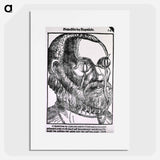 アートポスター-Treatment of Cyst
 - 国立医学図書館 Poster.