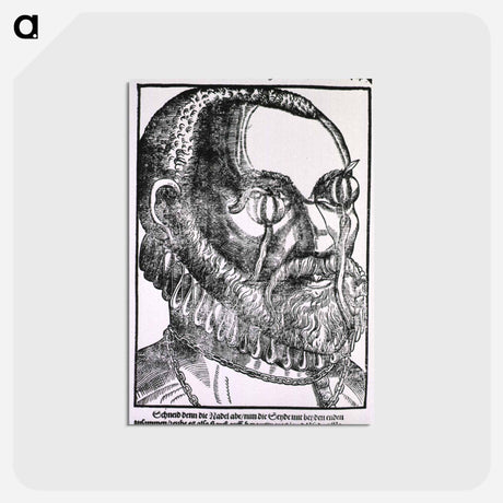 アートポストカード-Treatment of Cyst
 - 国立医学図書館 Postcard.