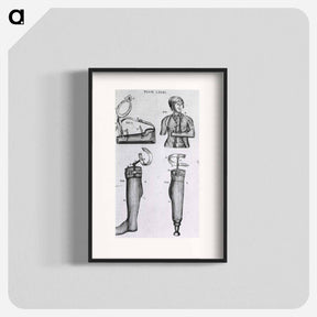 アートポスター-Arm Sling and Artificial Legs
 - 国立医学図書館 Poster.