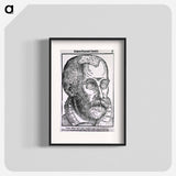 アートポスター-Man with Blue Cataract
 - 国立医学図書館 Poster.