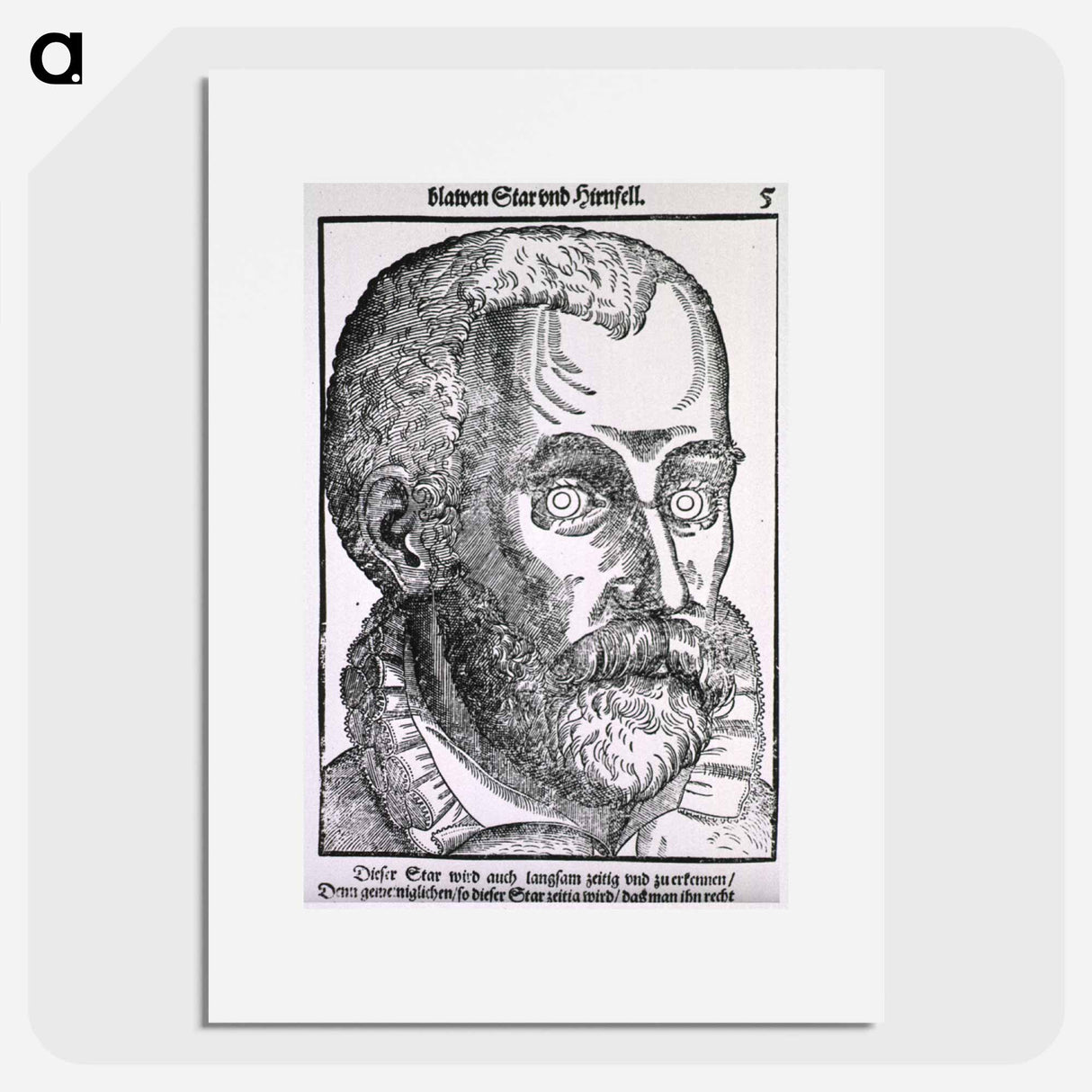 アートポスター-Man with Blue Cataract
 - 国立医学図書館 Poster.