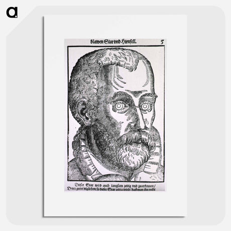 アートポスター-Man with Blue Cataract
 - 国立医学図書館 Poster.