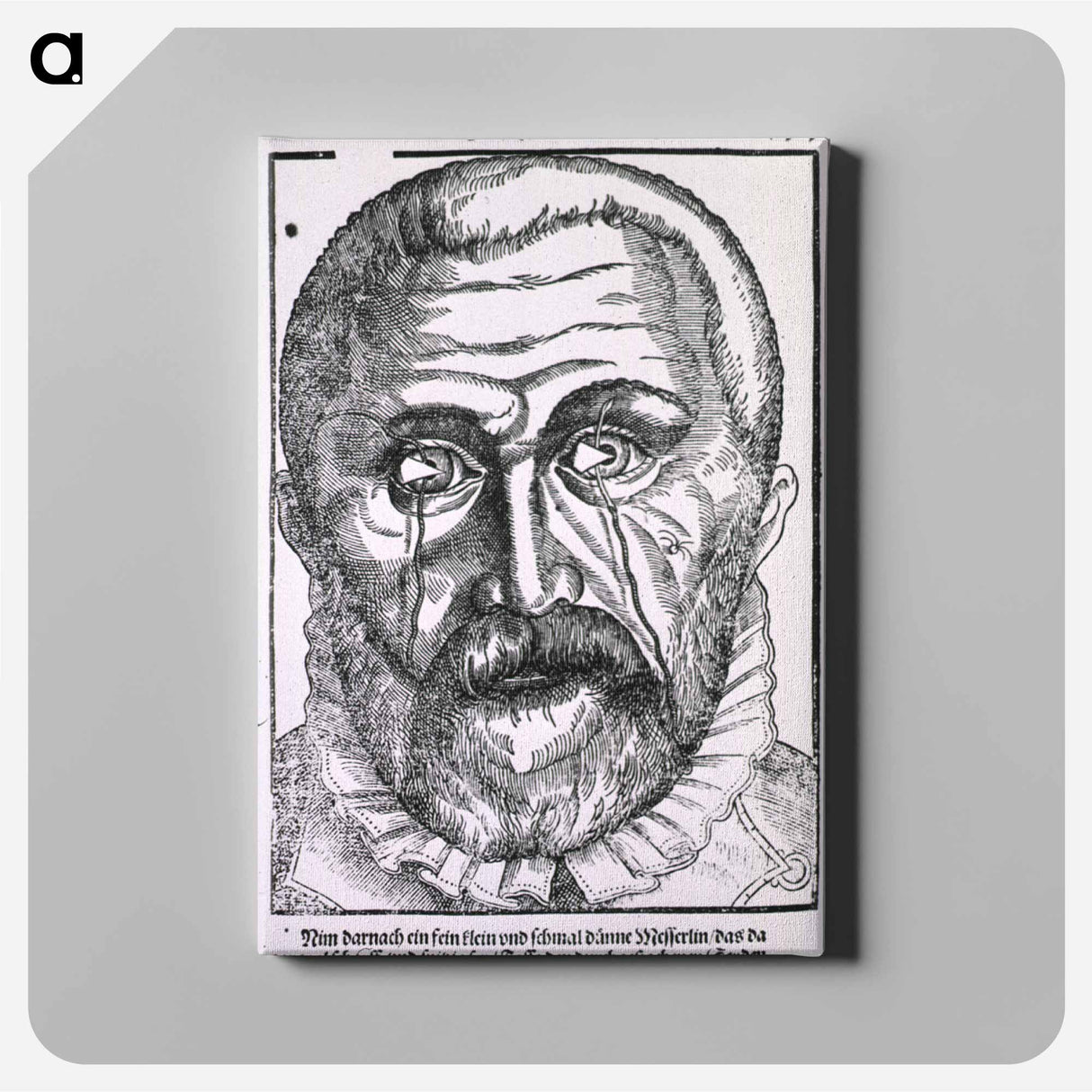 アートパネル-Surgical Treatment of Pterygium
 - 国立医学図書館 Canvas.