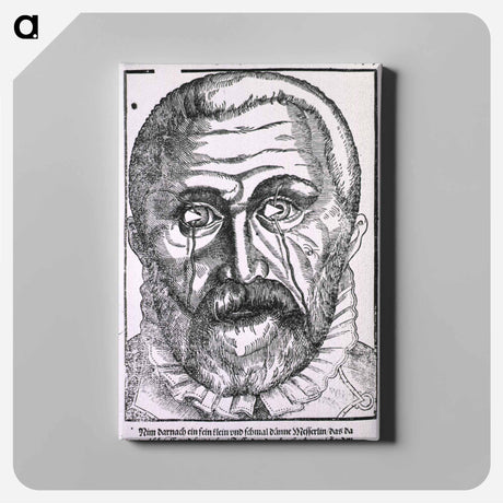 アートパネル-Surgical Treatment of Pterygium
 - 国立医学図書館 Canvas.