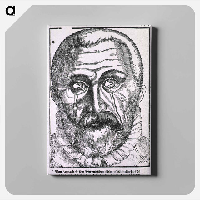 アートパネル-Surgical Treatment of Pterygium
 - 国立医学図書館 Canvas.