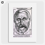 アートポスター-Surgical Treatment of Pterygium
 - 国立医学図書館 Poster.