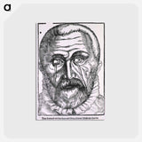 アートポストカード-Surgical Treatment of Pterygium
 - 国立医学図書館 Postcard.