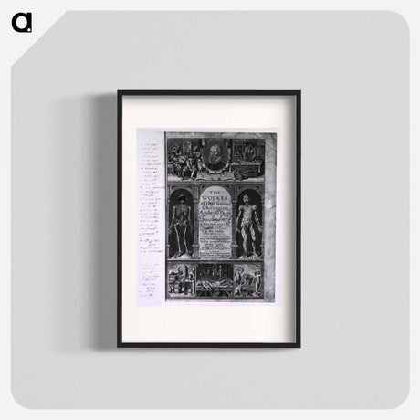 アートポスター-Workes of that Famous Chirurgion Ambrose Parey
 - 国立医学図書館 Poster.