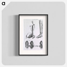 アートポスター-Leg Braces and Corrective Shoes
 - 国立医学図書館 Poster.