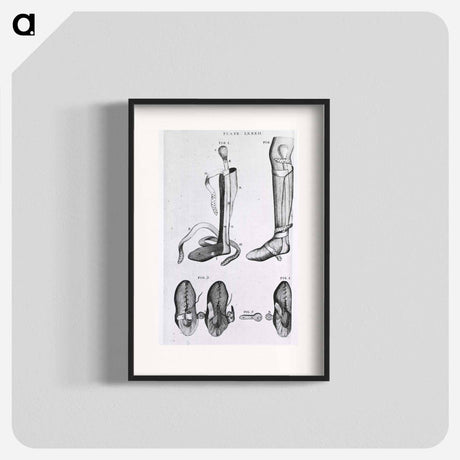 アートポスター-Leg Braces and Corrective Shoes
 - 国立医学図書館 Poster.
