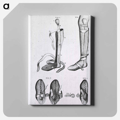アートパネル-Leg Braces and Corrective Shoes
 - 国立医学図書館 Canvas.