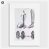 アートポスター-Leg Braces and Corrective Shoes
 - 国立医学図書館 Poster.