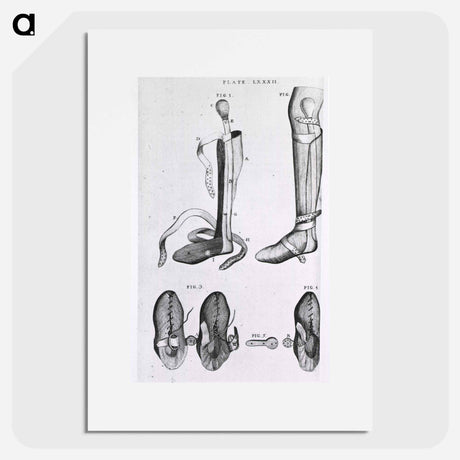 アートポスター-Leg Braces and Corrective Shoes
 - 国立医学図書館 Poster.