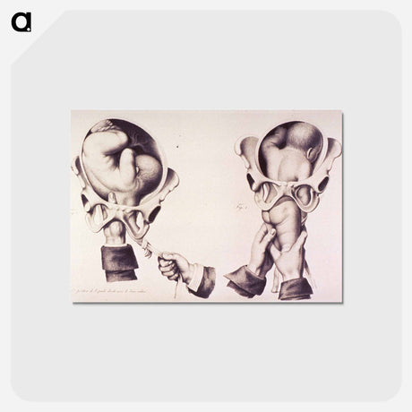 アートポストカード-Position de L'épaule Droite-avec le Bras Enlacé
 - 国立医学図書館 Postcard.