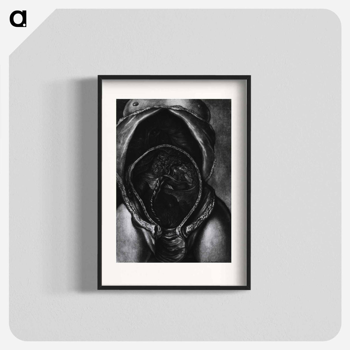 アートポスター-Uterus After Birth with Placenta Attached
 - 国立医学図書館 Poster.