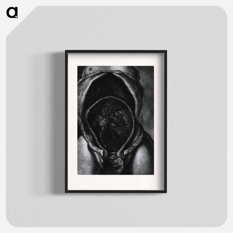 アートポスター-Uterus After Birth with Placenta Attached
 - 国立医学図書館 Poster.