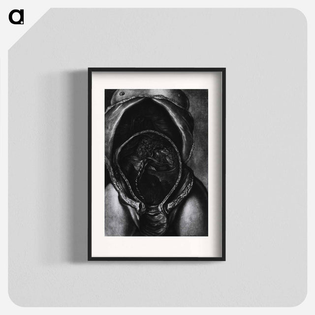 アートポスター-Uterus After Birth with Placenta Attached
 - 国立医学図書館 Poster.