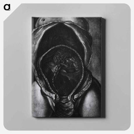 アートパネル-Uterus After Birth with Placenta Attached
 - 国立医学図書館 Canvas.