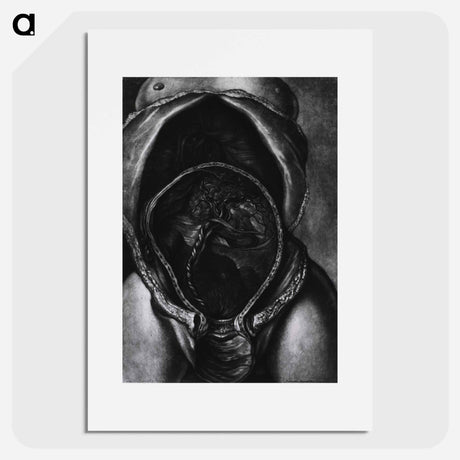 アートポスター-Uterus After Birth with Placenta Attached
 - 国立医学図書館 Poster.