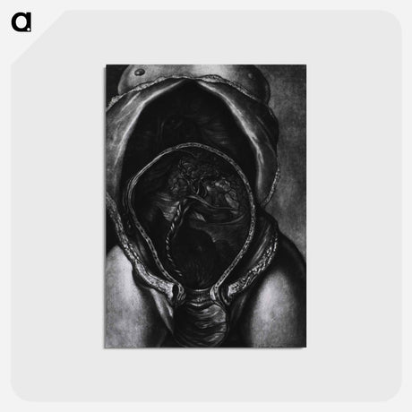 アートポストカード-Uterus After Birth with Placenta Attached
 - 国立医学図書館 Postcard.