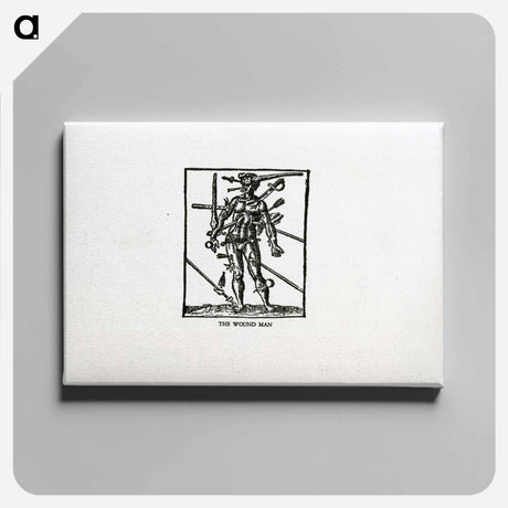 アートパネル-Bloodletting: The Wound Man
 - 国立医学図書館 Canvas.