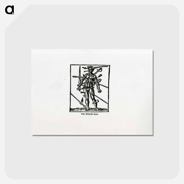 アートポストカード-Bloodletting: The Wound Man
 - 国立医学図書館 Postcard.