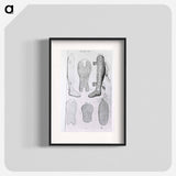 アートポスター-Orthopedic Splints or Braces
 - 国立医学図書館 Poster.