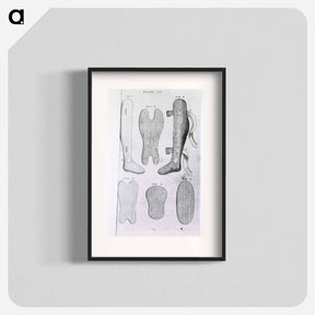 アートポスター-Orthopedic Splints or Braces
 - 国立医学図書館 Poster.