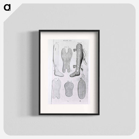 アートポスター-Orthopedic Splints or Braces
 - 国立医学図書館 Poster.