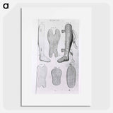 アートポスター-Orthopedic Splints or Braces
 - 国立医学図書館 Poster.