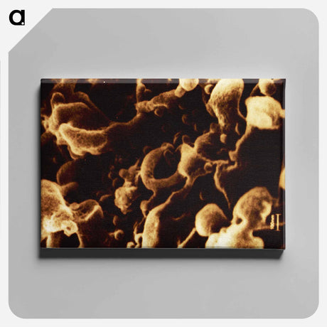 アートパネル-Human Immunodeficiency Virus Micrograph
 - 国立医学図書館 Canvas.