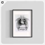 アートポスター-Distended Stomach and Colon
 - 国立医学図書館 Poster.
