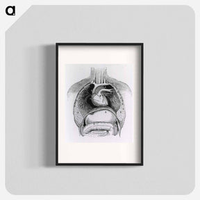 アートポスター-Distended Stomach and Colon
 - 国立医学図書館 Poster.