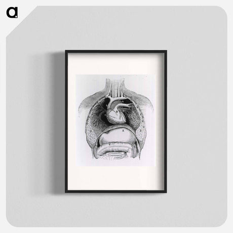 アートポスター-Distended Stomach and Colon
 - 国立医学図書館 Poster.