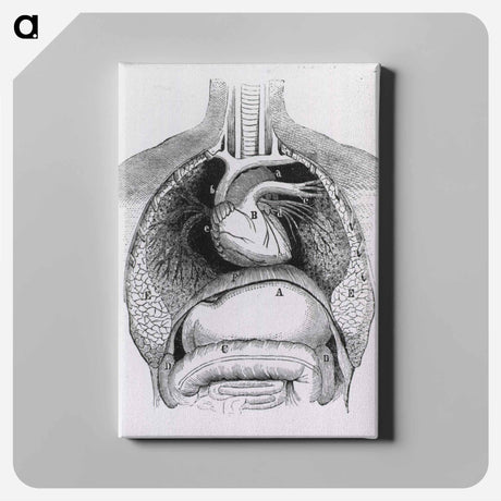 アートパネル-Distended Stomach and Colon
 - 国立医学図書館 Canvas.