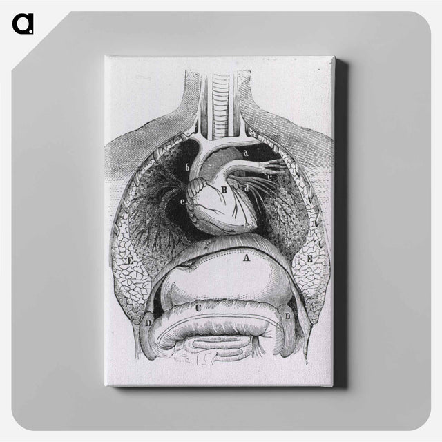 アートパネル-Distended Stomach and Colon
 - 国立医学図書館 Canvas.
