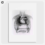 アートポスター-Distended Stomach and Colon
 - 国立医学図書館 Poster.