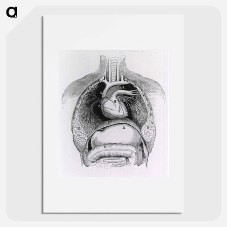 アートポスター-Distended Stomach and Colon
 - 国立医学図書館 Poster.