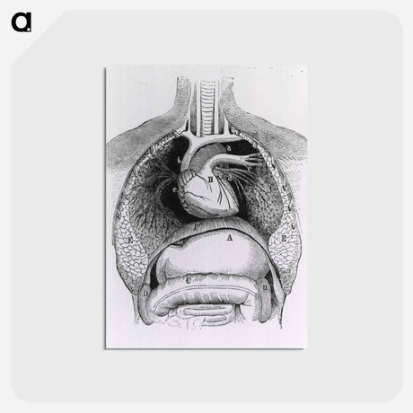 アートポストカード-Distended Stomach and Colon
 - 国立医学図書館 Postcard.